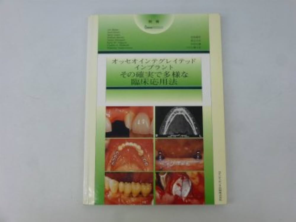 Amazon.co.jp: オッセオインテグレイテッドインプラントその確実